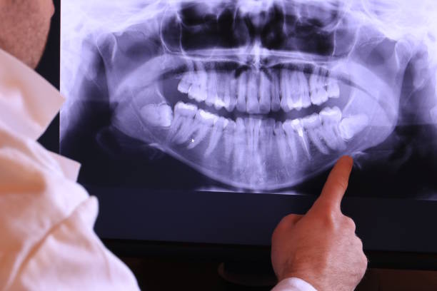 Best Emergency Tooth Extraction in Star, NC